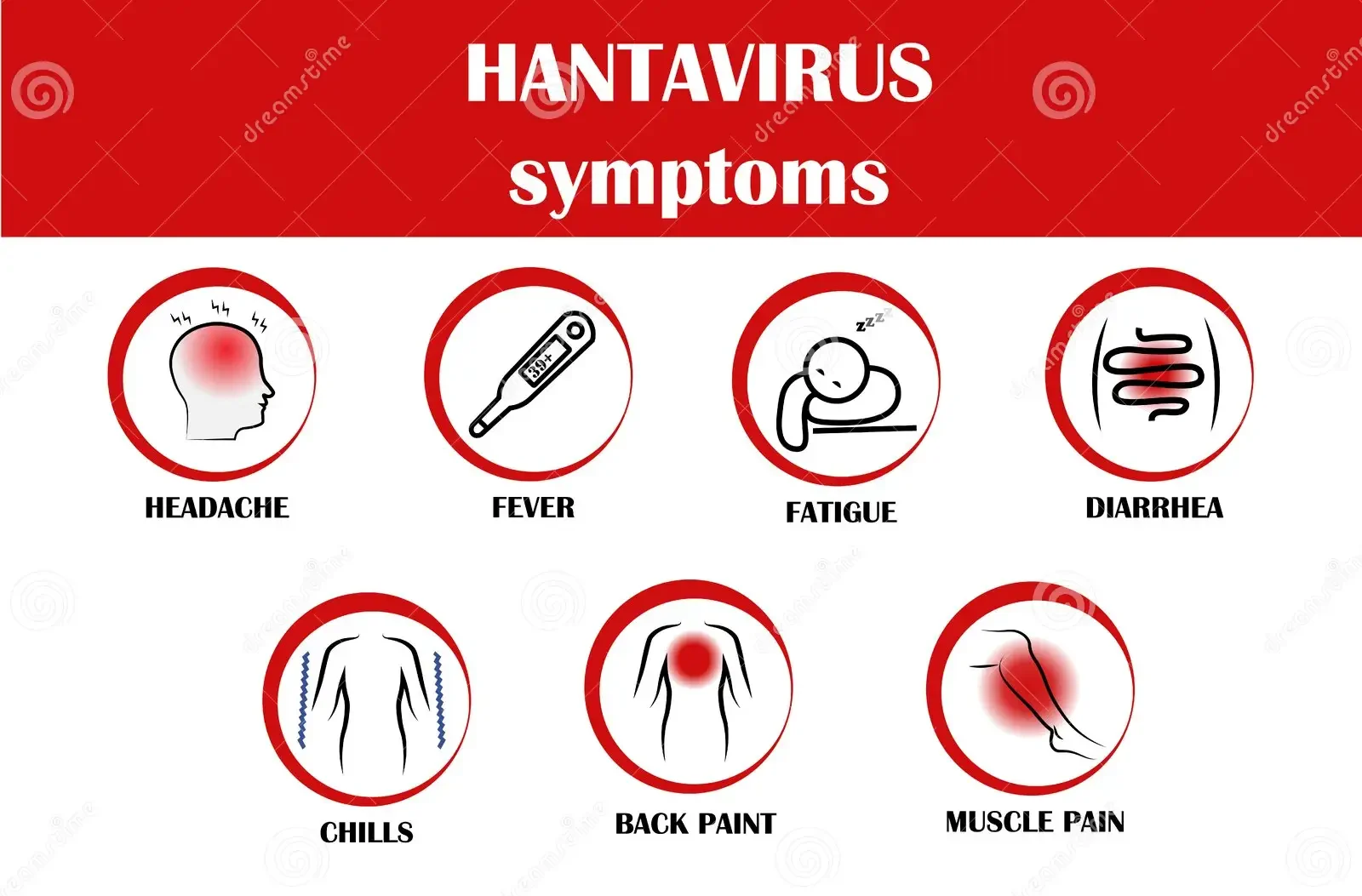 Hantavirus Symptoms: Early Warning Signs, Stages, and What to Do